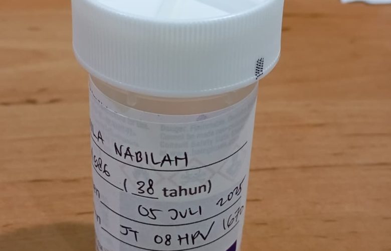 Sampel lendir serviks untuk tes DNA HPV